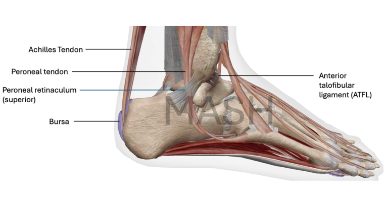 Figure: Ankle showing structures which can cause ankle pain